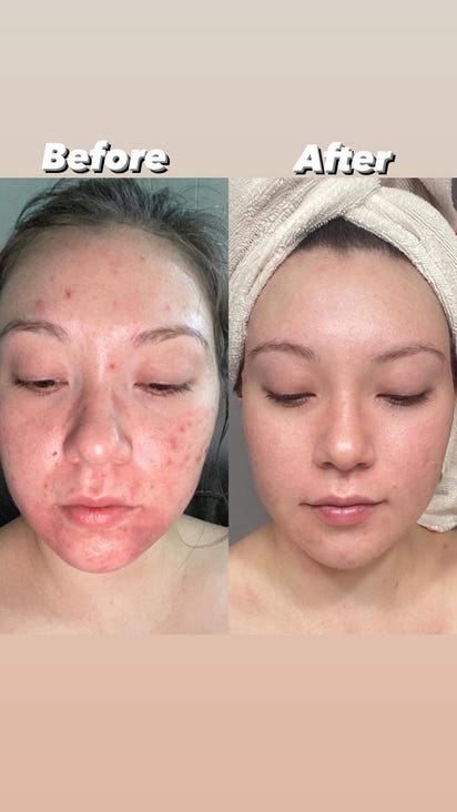 ✨ Mitra One 5-in-1 Facial Serum