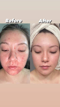 ✨ Mitra One 5-in-1 Facial Serum