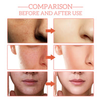 ✨ Mitra One 5-in-1 Facial Serum